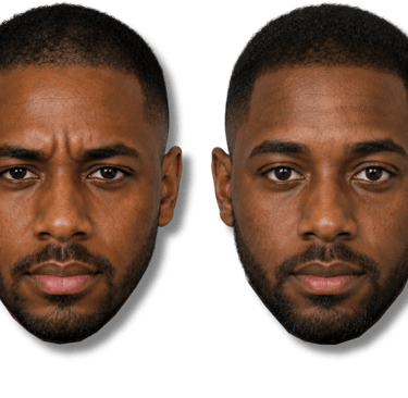 Side-by-side comparison of a man before and after SMP treatment..