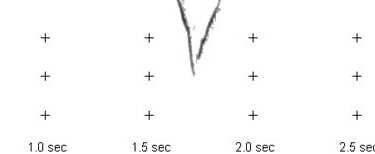 A random Yellow-browed Warbler