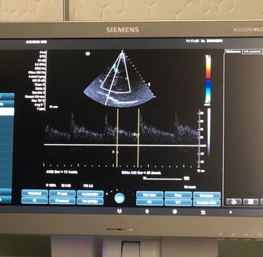 Taller para localizar la arteria cerebral media