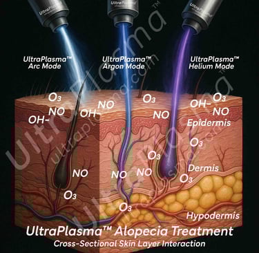 _ultra_plasma_ultra_plazma_ultra-plasma_ultra-plazma