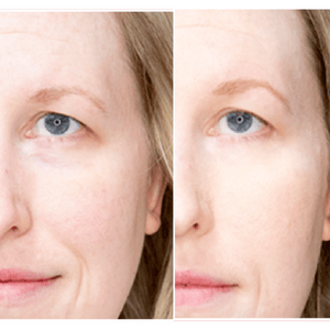 Lifevantage Collagen Before and After Results - woman face