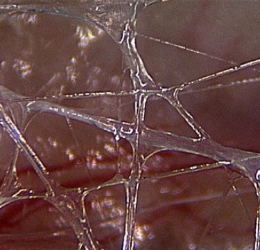 a Jean-Claude Guimberteau image about the interior of human body, biotensegrity