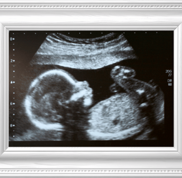 Ultrasound of baby in white frame