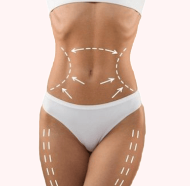lipo enzimatica em bh