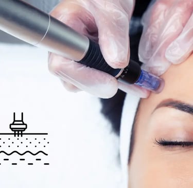 Microneedling-visage-femme