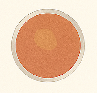 Trichomoniasis dish illustration