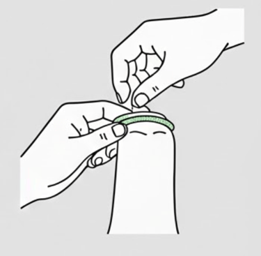 2 hands putting condom on with foreskin