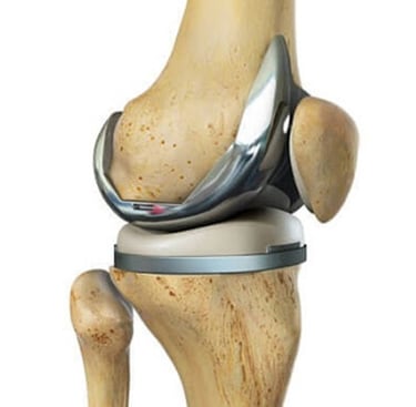best knee replacement in jayanagar