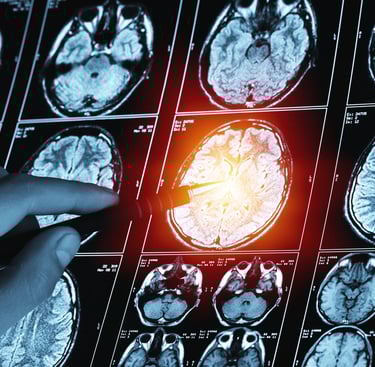 Image de scanner de traumatisme cranien