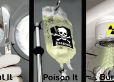 Modern fight against cancer: cut it, poison it, burn it