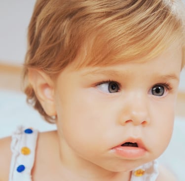 Child with amblyopia (lazy eye)