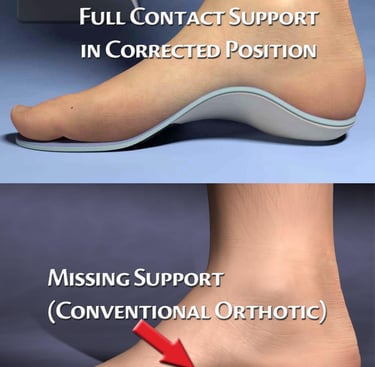 flat foot suppport in muscat