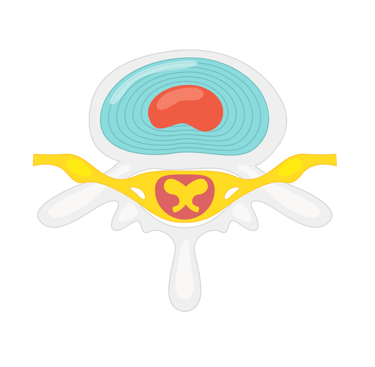 hernie-discale-osteopathe-strasbourg