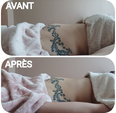 avant/après drainage renata franca grenoble