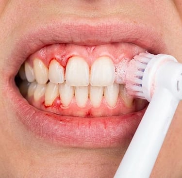 Las desventajas de los cepillos dentales rotativos hygiene-precision.com