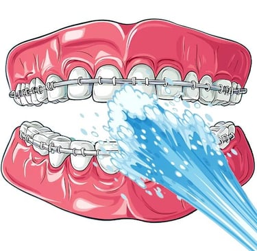 Nettoyer appareil orthodontique avec jet dentaire ozone Aquolab hygiene-precision.com