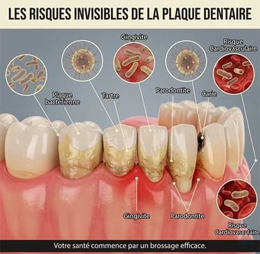 Les risques de la plaque dentaire sur la santé hygiene-precision.com