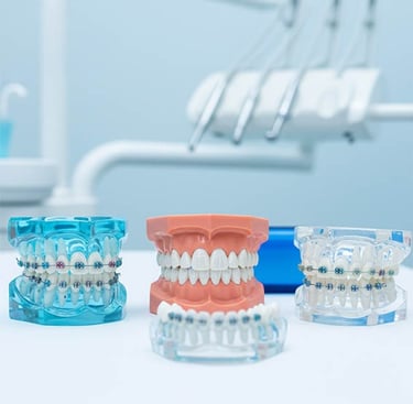 Traitement orthodontique pour adultes hygiene-precision.com