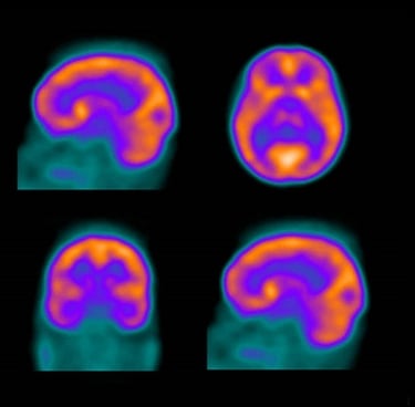 Nuc Med & PET Physics Survey