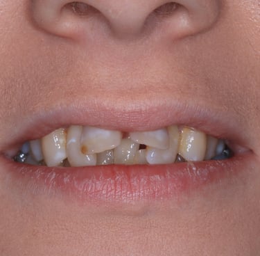 pictures of teeth