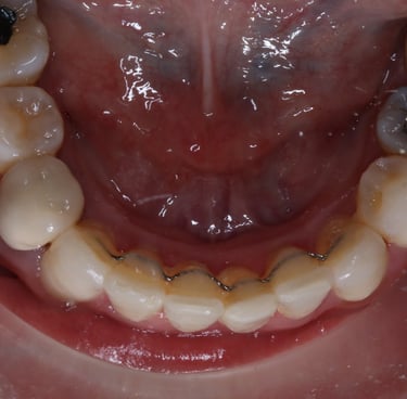 pictures of teeth