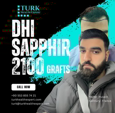 before and after hair transplant turkey with dhi