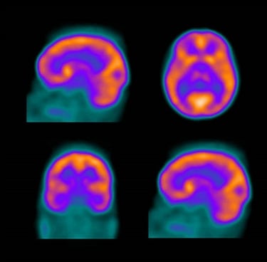 Nuc Med & PET Physics Survey