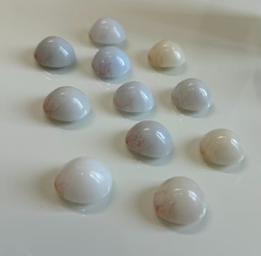sclère oculariste prothese oculaire avfrance awada nice france