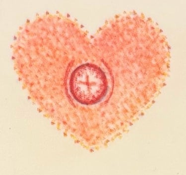 Post mastectomy tattoo: Orange heart shaped areola and nipple tattoo