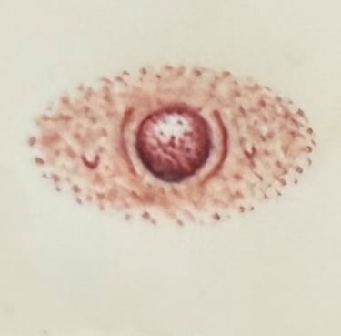 Post mastectomy tattoo option 1: Oval areola and nipple tattoo