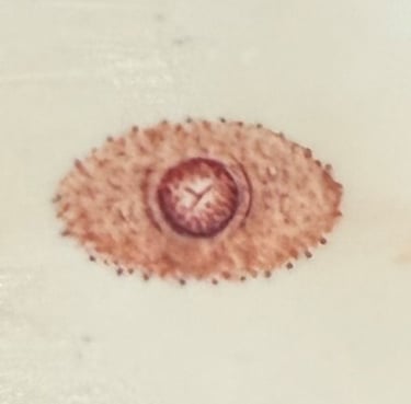 Post mastectomy tattoo option 2: Oval areola and nipple tattoo