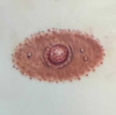Post mastectomy tattoo option 3: Oval areola and nipple tattoo