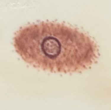 Post mastectomy tattoo option 4: Oval areola and nipple tattoo