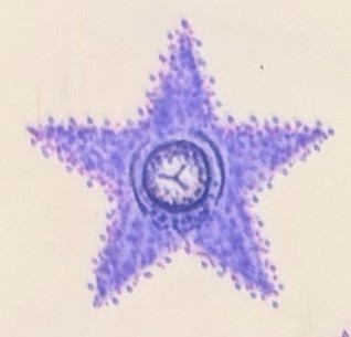 Post mastectomy tattoo: Purple star shaped areola and nipple tattoo