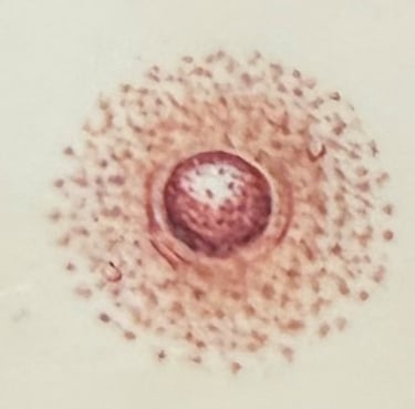 Post mastectomy tattoo option 1: Round areola and nipple tattoo