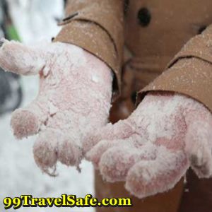 Preventing and Treating Frostbite