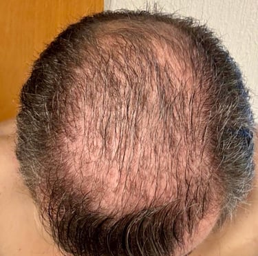 Inicio de rutina capilar con AUREVIA™