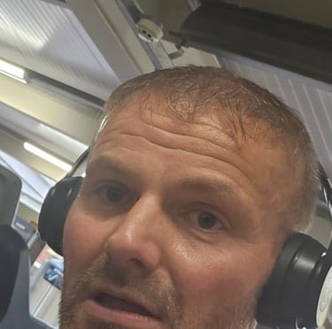 a man before his anti wrinkle injections treatment