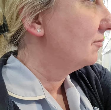 a women after her weight loss treatment
