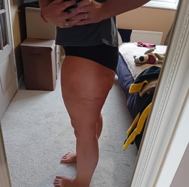 a women after her weight loss injections treatment