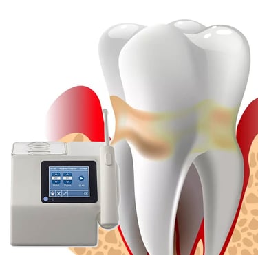 cuidado natural para la periodontitis y las encías inflamadas: irrigador dental al ozono