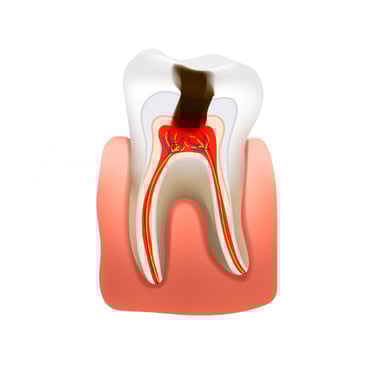tooth removal in baner
