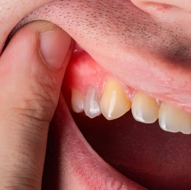 gum dental solution near me