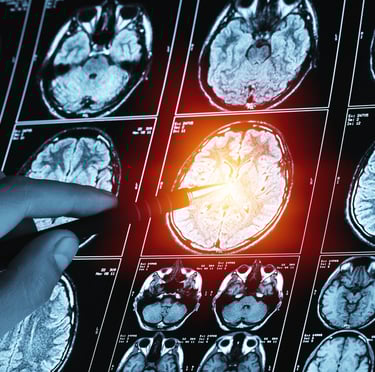 imagerie medicale pouvant évoquer les séquelles d'un TC ou un AVC