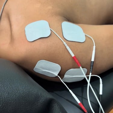Transcutaneous Electrical Nerve Stimulation 