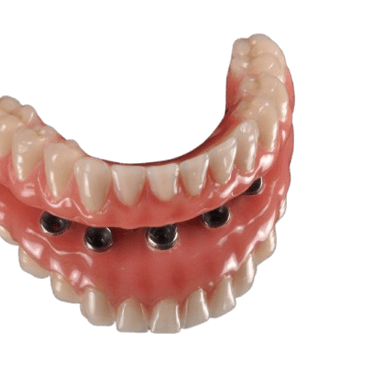 implante dentário