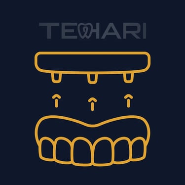 Prótese protocolo na clínica Tehari odontologia em Osasco e Americana SP