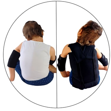 Antes y después con el chaleco corrector postural y sensorial MiSara Hug my Body