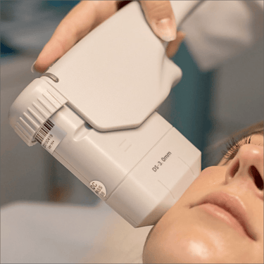 lifting facial ibiza HIFU