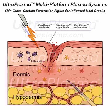 ultra_plasma_ultra_plazma_ultra-plasma_ultra-plazma